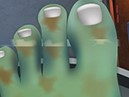 Monsternageldoktor